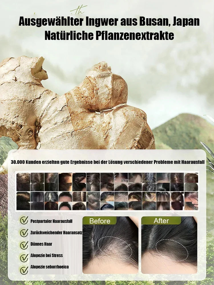 💥Explosive Ginger Phytochemical Hair Loss Control Shampoo💥